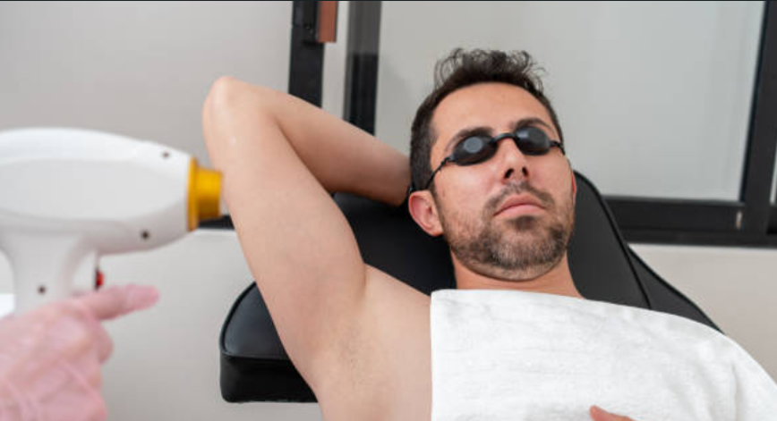 Men's Full Body Laser Hair Removal