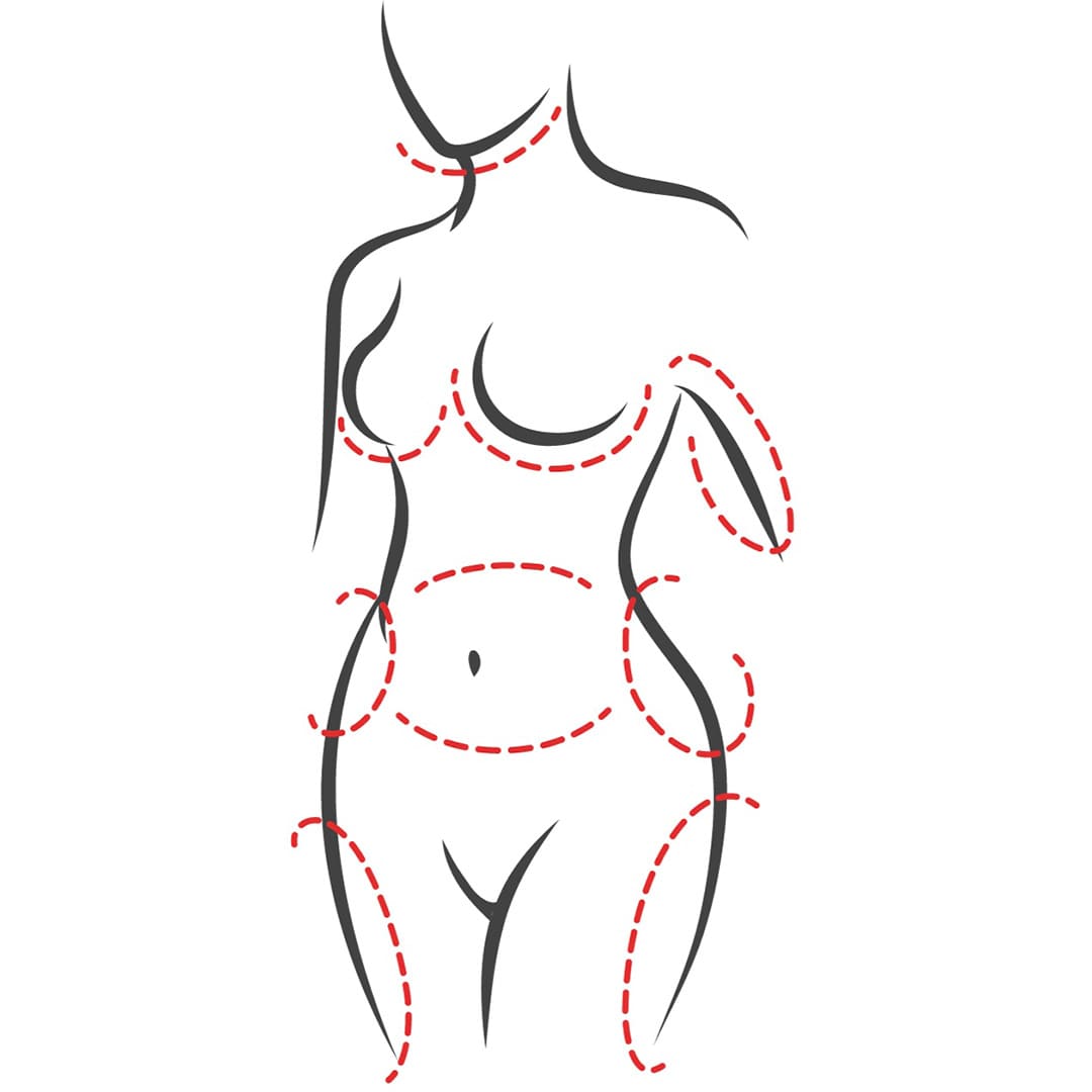 The following body areas are commonly targeted for liposuction treatment