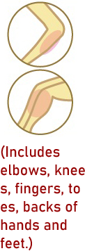 Forearms and Lower Legs Laser Hair Removal Package