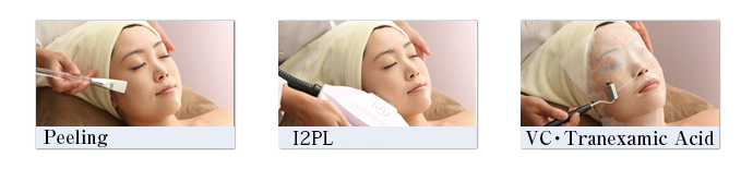Peeling+I2PL+VitC,Tranexamic Acid treatment